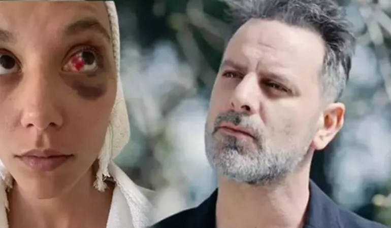 ozan-guven-tutuklanacak-abajurla-kadina-siddet-uygulamisti-XYwfmNVc.jpg