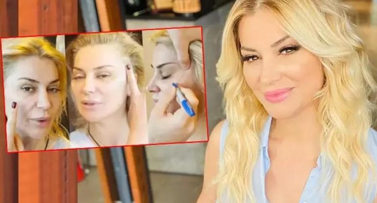 son hali olay olmustu songul karli estetik mi oldu ilk kez acikladi 0 fL1ciZ3H