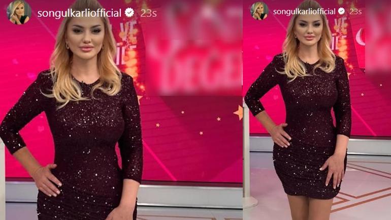 son hali olay olmustu songul karli estetik mi oldu ilk kez acikladi 2 374WJFll