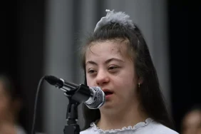 trabzon-da-down-sendromlulardan-olusan-koro-i-4-19674027_amp